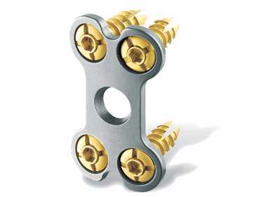 osmium_ventajas