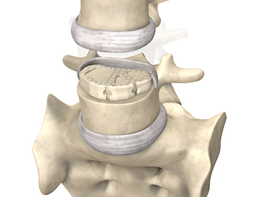 semial_indicaciones
